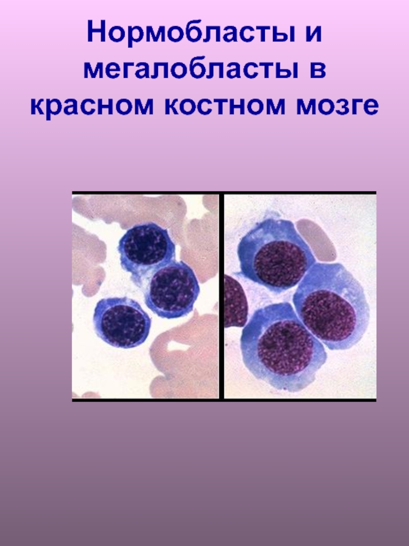 Нормоцит это. Оксифильный нормобласт. Базофильный нормобласт. Нормобласты и мегалобласты. Базофильный нормоцит.