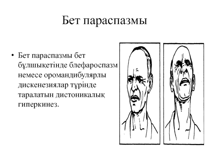 Гиперкинезы возникают при поражении