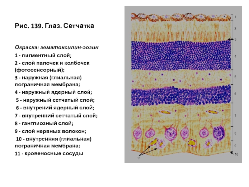 Сетчатка рисунок гистология