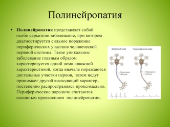 Полинейропатия. Симптомы