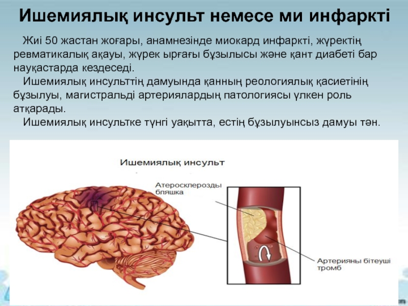 Инсульт презентация 8 класс