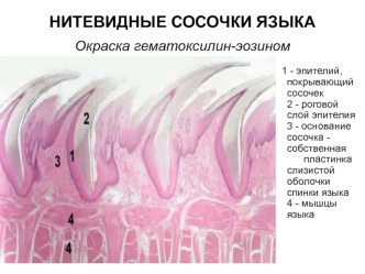 Нитевидные сосочки языка. Окраска гематоксилин-эозином