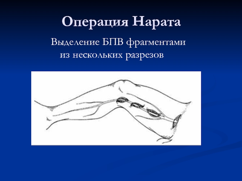 Топографо анатомический. Клинико-Анатомическое обоснование тарусальной анестезии.. Топографо Анатомическое обоснование осиплости голоса. Объясните и обоснуйте анатомически причину некроза сухожилий..