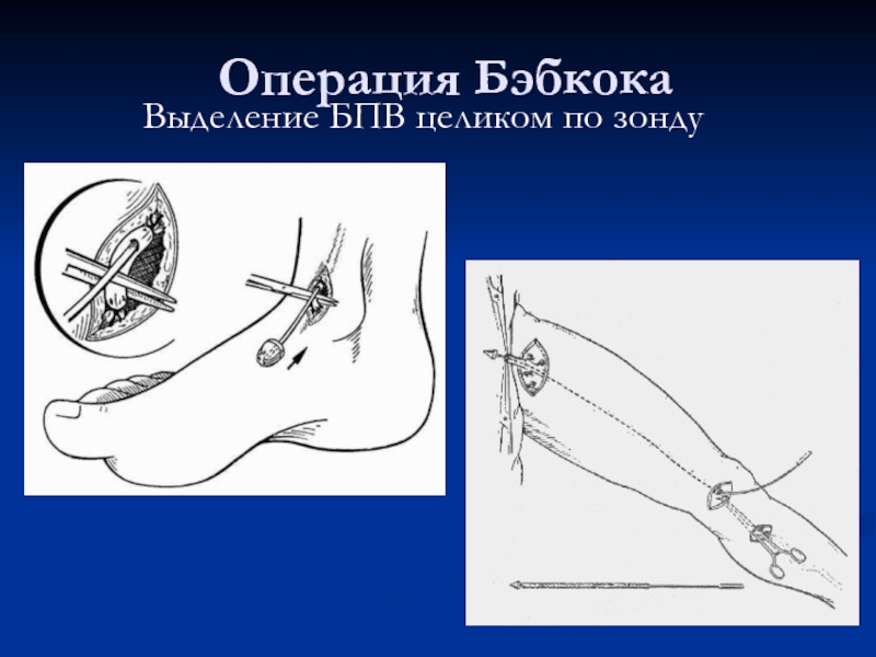 Топографо анатомический. Топографо анатомические обоснование разрезов при панариции. Объясните и обоснуйте анатомически причину некроза сухожилий..