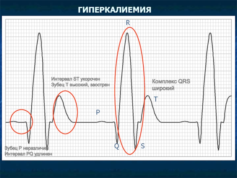 Высокий т