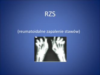 RZS (reumatoidalne zapalenie stawów)