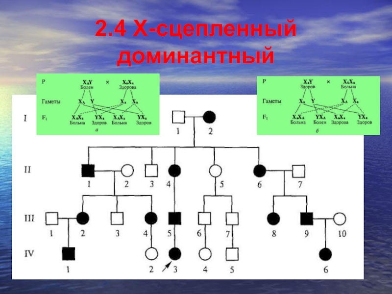 Сцеплен с х хромосомой доминантный