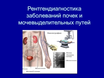 Рентгендиагностика заболеваний почек и мочевыделительных путей