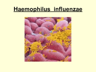 Haemophilus influenzae. Таксономия