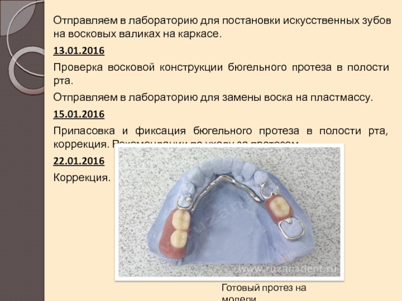 Проверка конструкции протезов при полном отсутствии зубов презентация