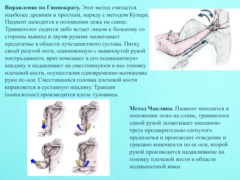 Вывих плечевого сустава карта вызова локальный статус