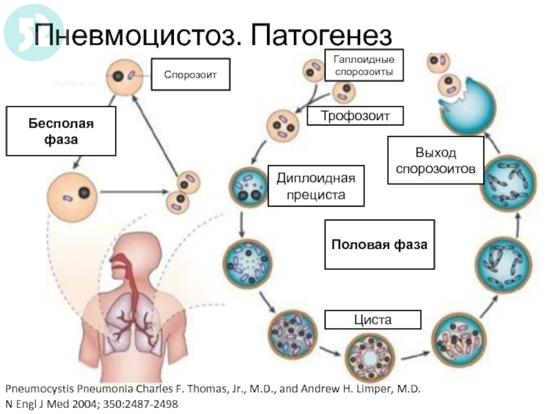 Пневмоцистоз клиническая картина