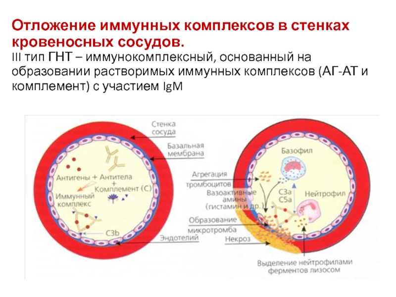 Иммунные образования