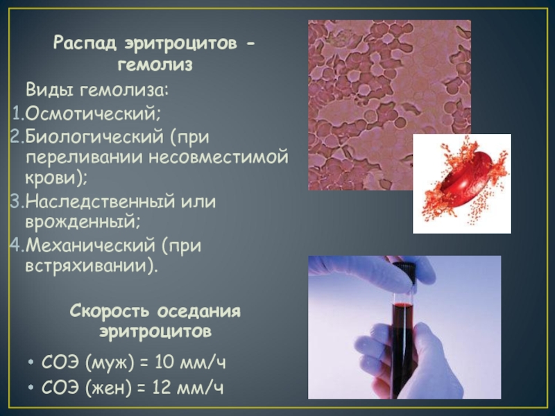 Распад крови. Гемолиз эритроцитов в крови. Механический гемолиз эритроцитов. Продукты распада эритроцитов. Распад эритроцитов причины.