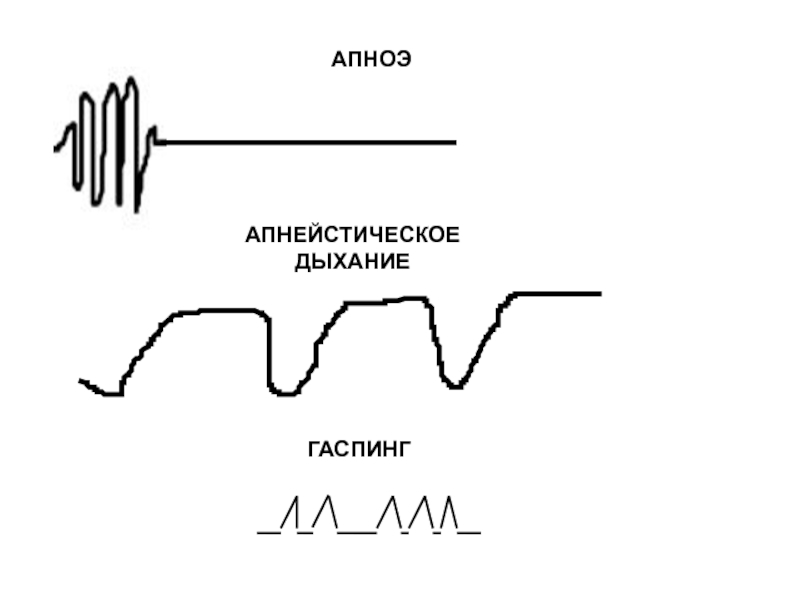 Апнейстическое дыхание рисунок