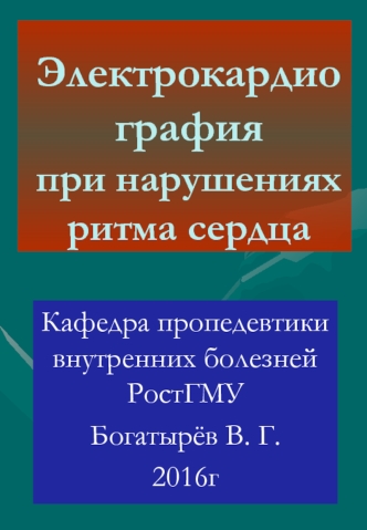 Электрокардиография при нарушениях ритма сердца