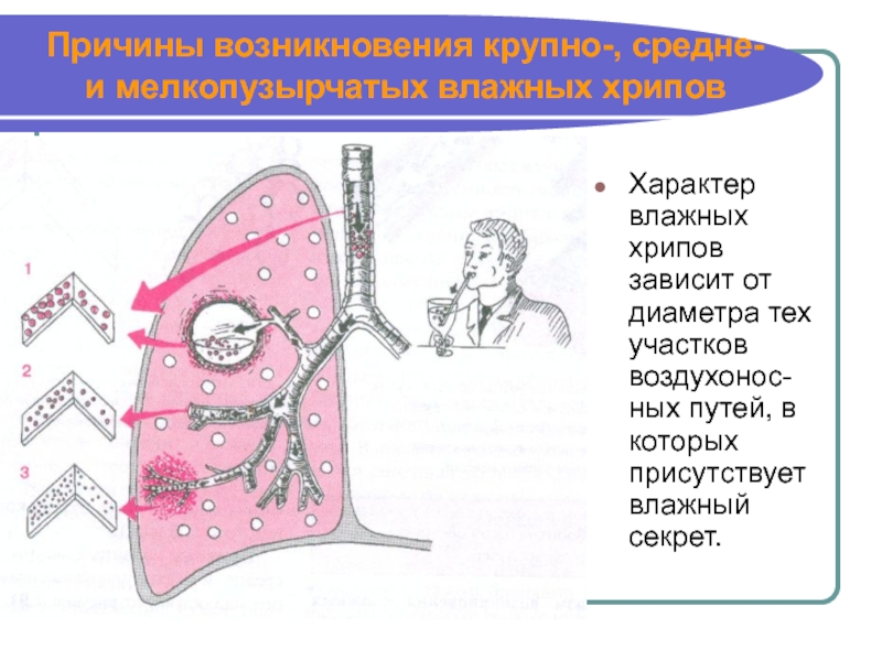 Звуки хрип