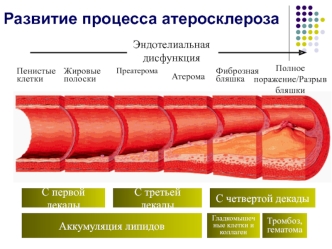 Развитие процесса атеросклероза