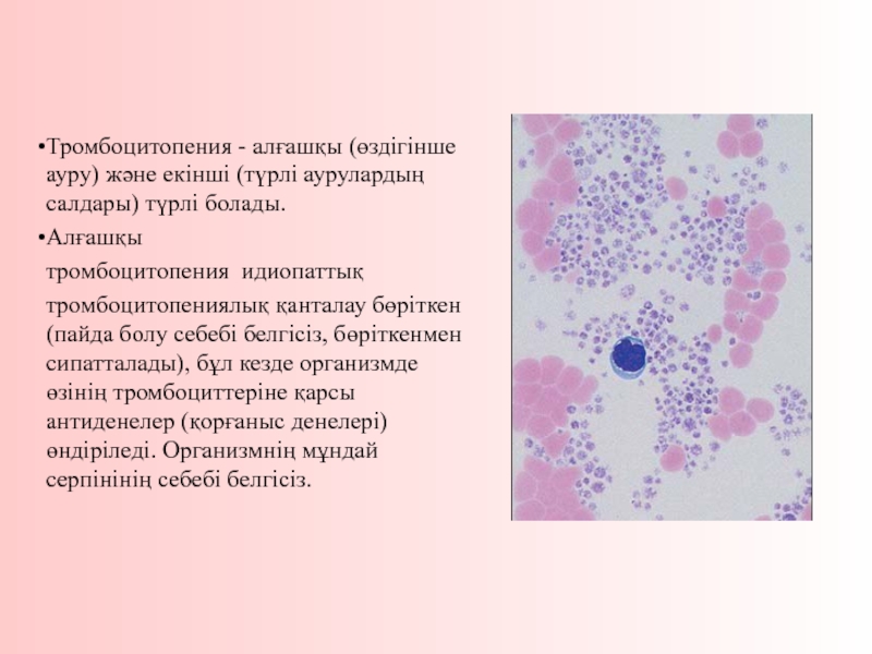 Формы тромбоцитопении