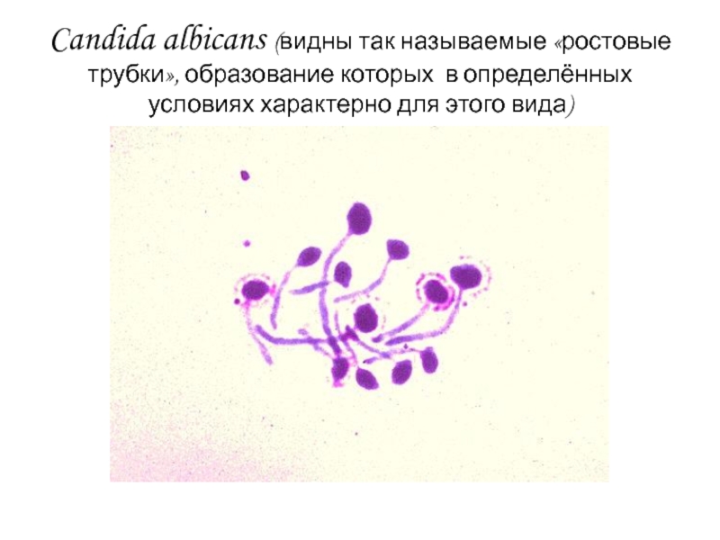 Споры candida. Candida albicans мицелий. Candida albicans микроскопия. Candida albicans по Граму. Candida albicans окраска по Граму.