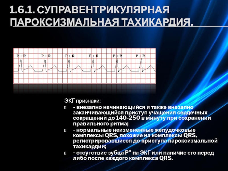 Пароксизмальная тахикардия презентация