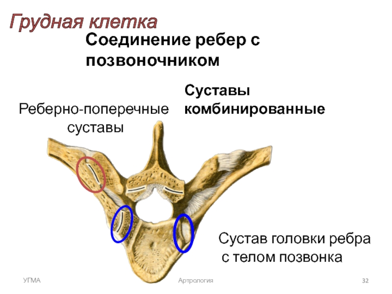 Ребро тип соединения. Реберно Позвоночный сустав анатомия. Сустав головки ребра и реберно поперечный сустав. Соединения сустава головки ребра. Соединение ребра с грудным позвонком.