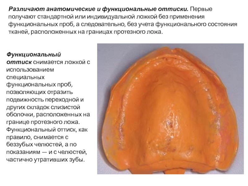 Протезное ложе. Функциональный оттиск беззубой челюсти. Снятие функциональных оттисков с беззубых челюстей. Анатомические и функциональные оттиски. Функциональный оттиск.