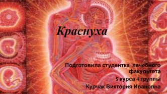 Краснуха. Источник инфекции