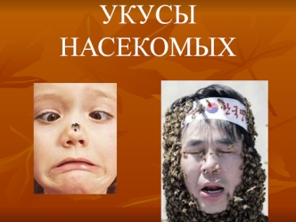 Укусы насекомых