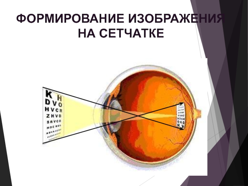 Неравенство величин изображения одного и того же предмета на сетчатке называется