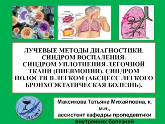 Лучевые методы диагностики. Синдром воспаления. Синдром уплотнения легочной ткани (пневмонии)