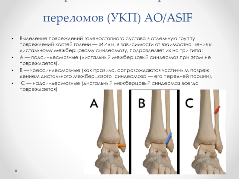 Закрытый перелом лодыжки карта вызова