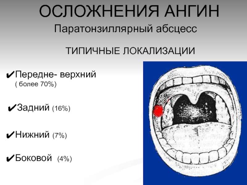 Паратонзиллярный абсцесс локальный статус карта вызова