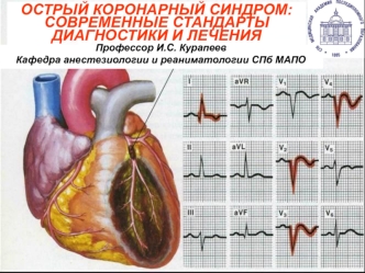 Острый коронарный синдром: современные стандарты диагностики и лечения