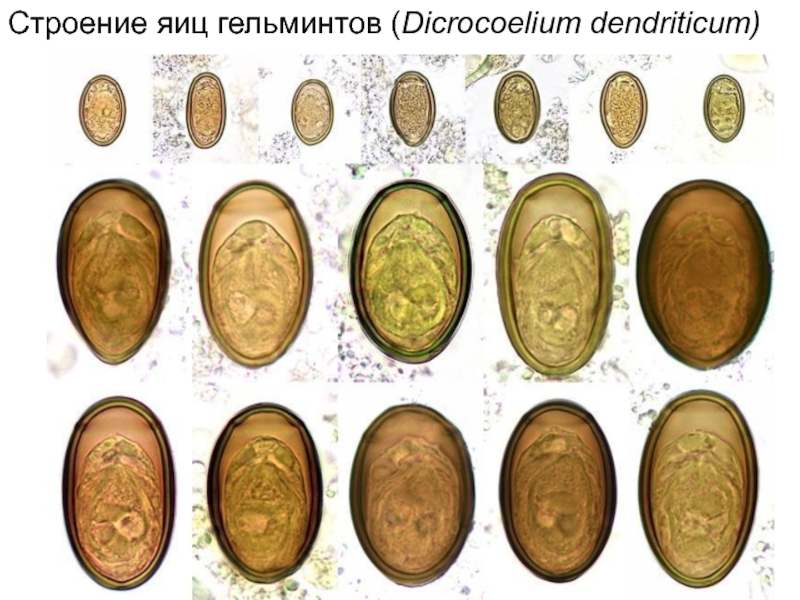 Яйца гельминтов рисунок