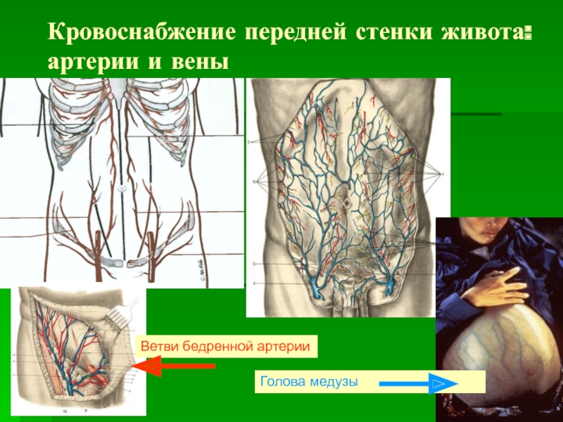 Передняя стенка живота