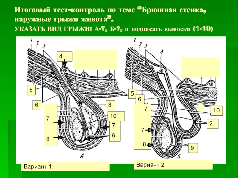 Наружные и внутренние грыжи живота презентация