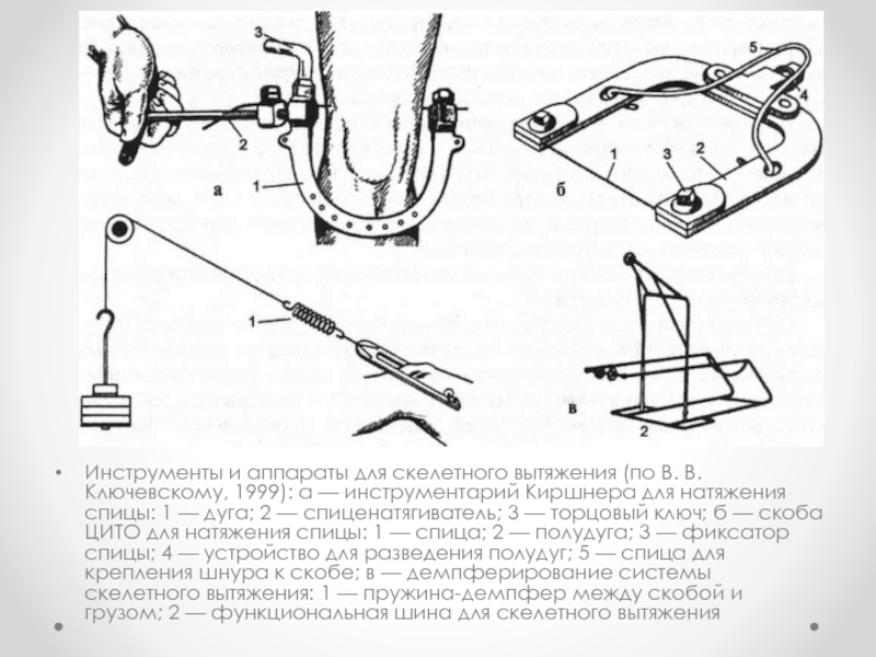 Скелетное вытяжение презентация