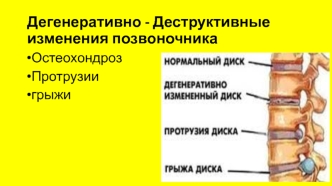 Дегенеративно -диструктивные изменения позвоночника