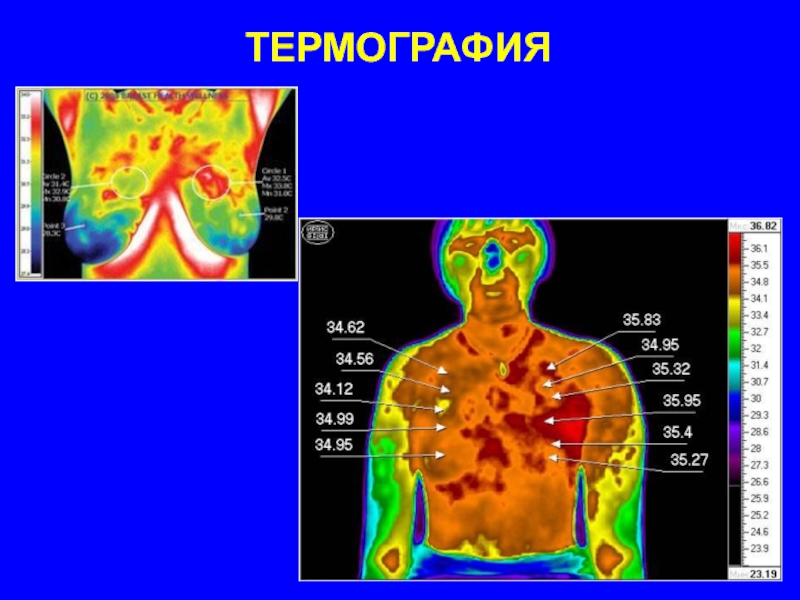 Медицинская термография презентация