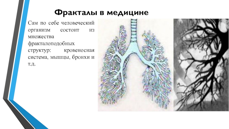 Применение фракталов. Фракталы в медицине. Фракталы бронхи. Фракталы в медицине кровеносная система. Применение фракталов в медицине.