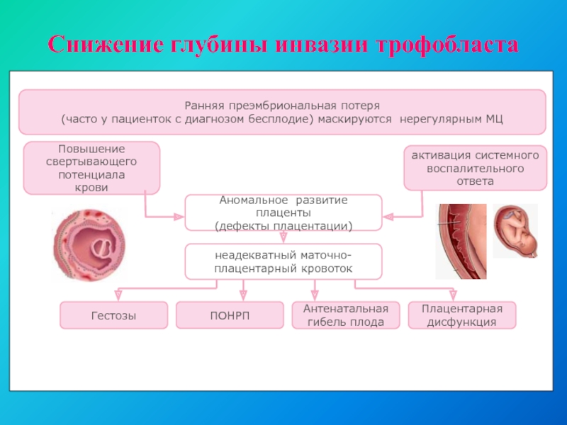 Аномалии развития плаценты презентация