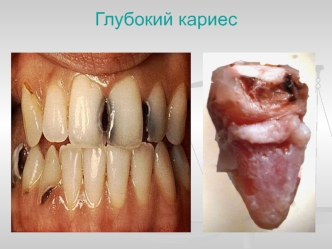 Макроскопические изменения органов и тканей. Фотографии с подписями