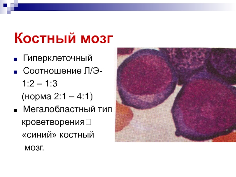 Э л это. Соотношение кроветворного и жирового костного мозга. Мегалобластический Тип кроветворения. Кроветворение в костном мозге.