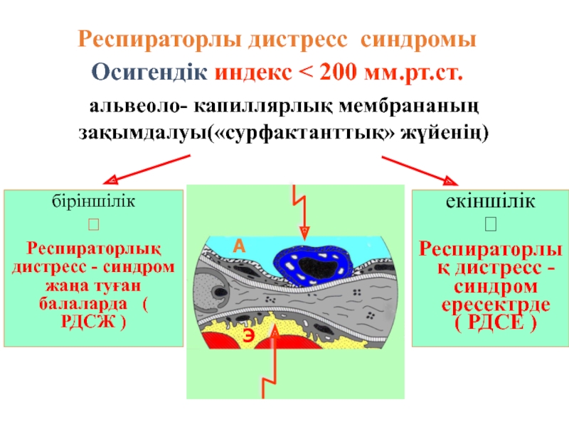 B дистресс