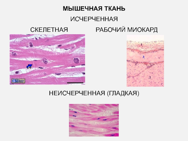 Строение клетки гладкая мышечная ткань