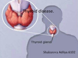 Thyroid disease