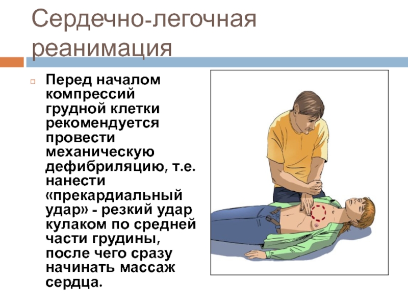 Компрессии грудной клетки при проведении сердечно легочной. Глубина компрессий грудной клетки при СЛР. Компрессии грудной клетки при СЛР. Сердечно-лёгочная реанимация. Сердечно-легочная реанимация пострадавшего.