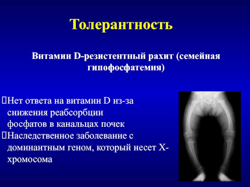 Витамин д резистентный рахит. Гипофосфатемическом рахите. Гипофосфатемический витамин d-резистентный. Витамин d-резистентный рахит.