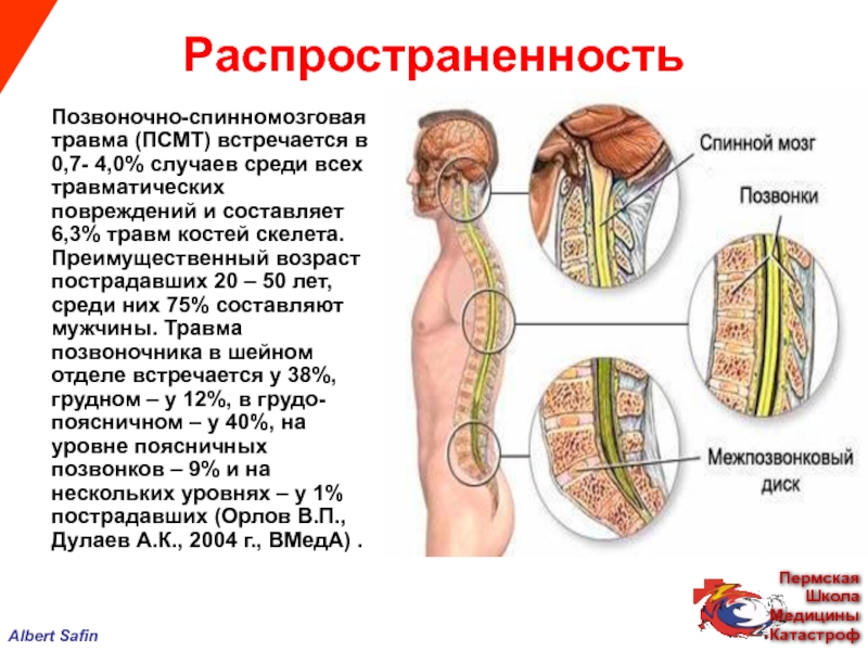 Реферат: Травма позвоночника, спинного и головного мозга